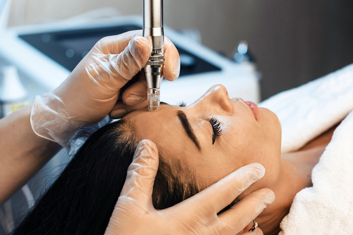 Microneedling Mesotherapy